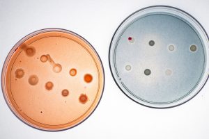 " ... hemos hecho ensayos y hemos visto que ocurre si utilizamos o no microorganismos en fertiriego con lechuga y pimentones y se nota la diferencia. Un crecimiento fuerte, entre otras características", señala la Dra. Stoll.